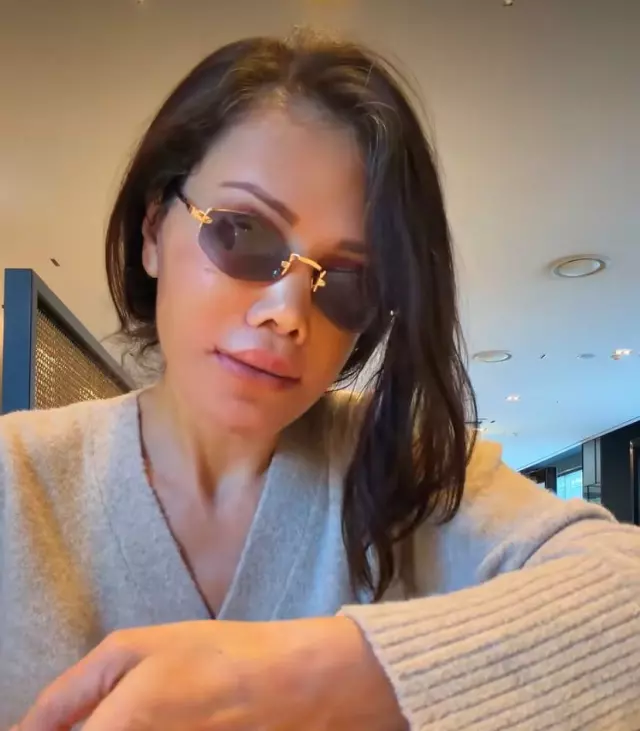 Didem Ceran after facial aesthetic surgery