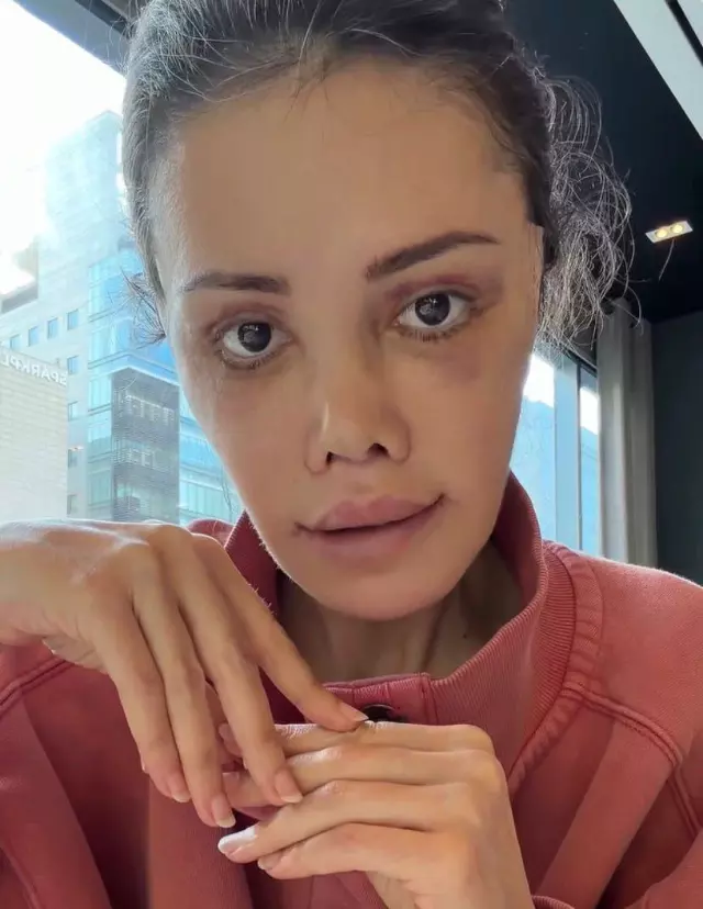 Didem Ceran responds to followers’ comments