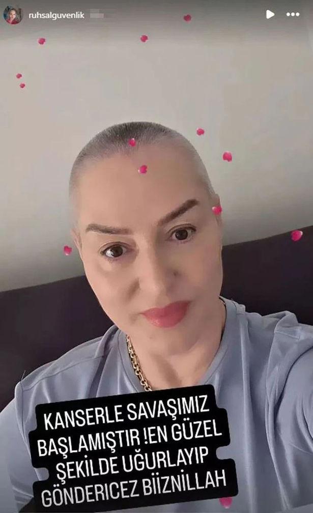Şıvga Gerez during cancer treatment
