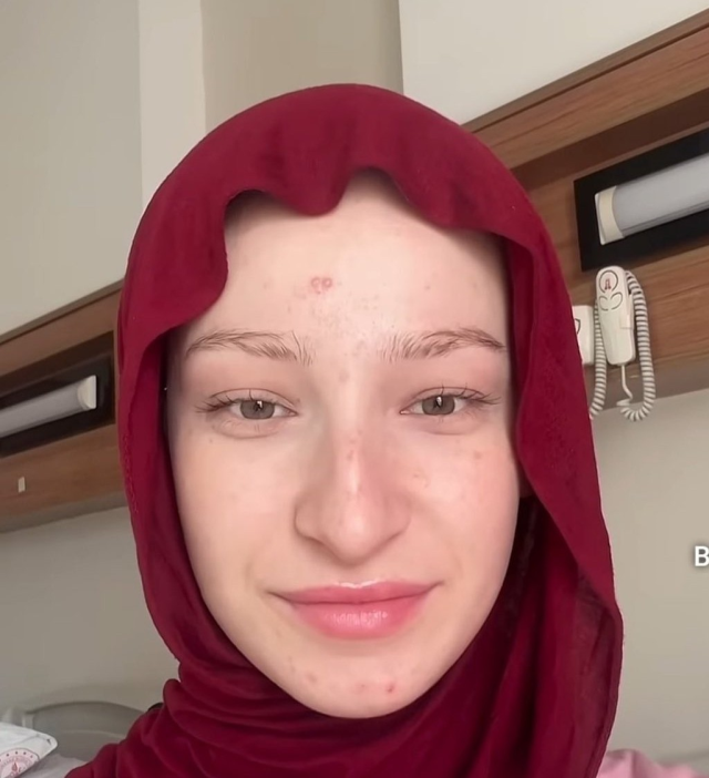 Imagen antigua de Fatma Soydas sin cirugias